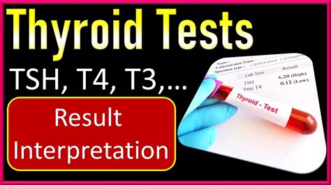 Islamabad Diagnostic Centre (IDC) Thyroid Profile (T3, T4, TSH) .